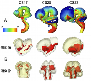 Neuroimage