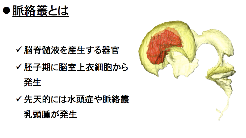 脈絡 叢 嚢胞 消え なかっ た